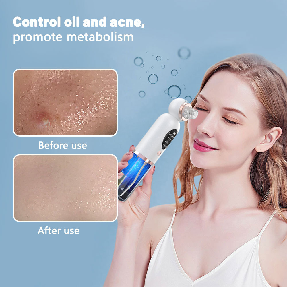 Pore Vacuum - Blackhead Remover Pore Vacuum Face Cleaner