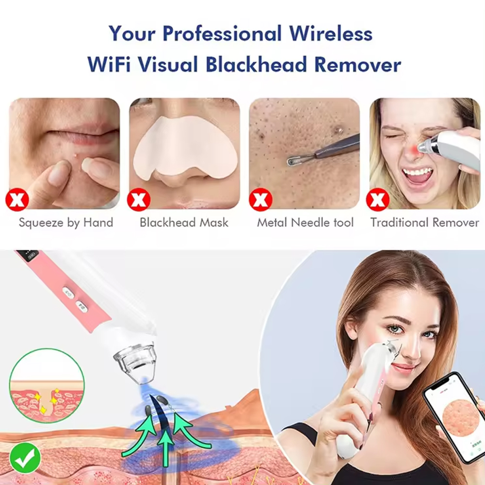 6 Heads Pore Cleaner Blackhead - огляд і ціна Pore Vacuum