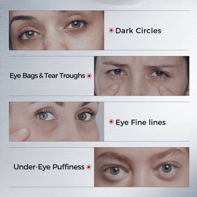 Eye Patches for Dark Circles – - огляд і ціна Collagen Eye Patch