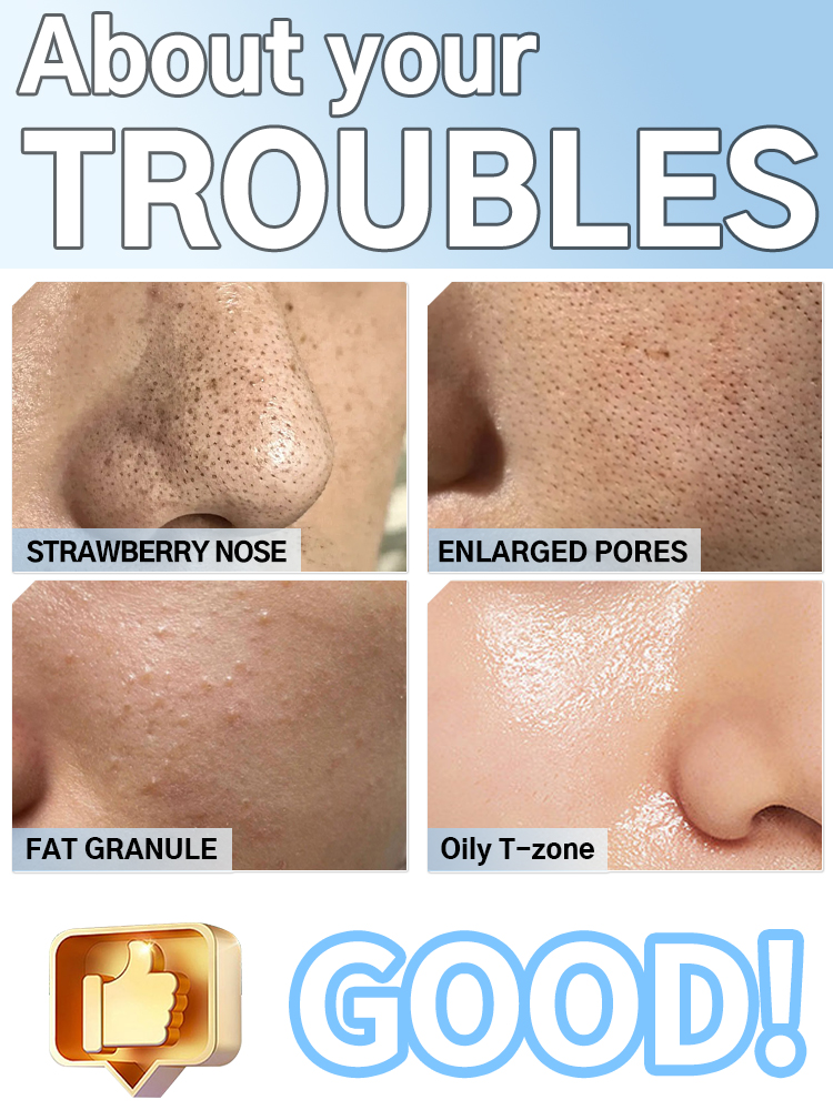 Blackhead Remover Pore Cleaner - огляд і ціна Pore Vacuum