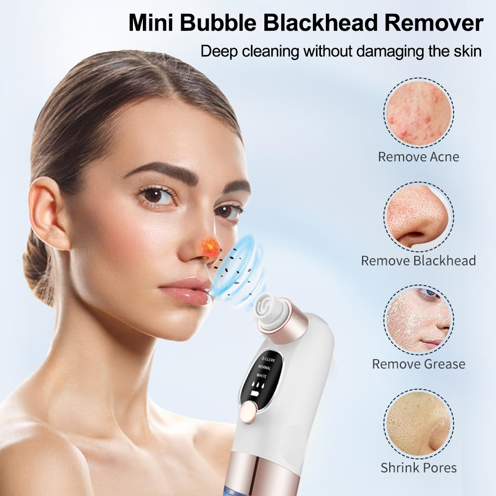 Electric Blackhead Remover Vac - огляд і ціна Pore Vacuum