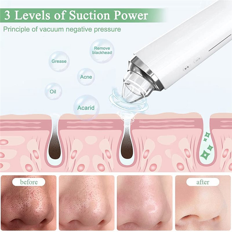 【FITTING】Blackhead Remover Por - огляд і ціна Pore Vacuum