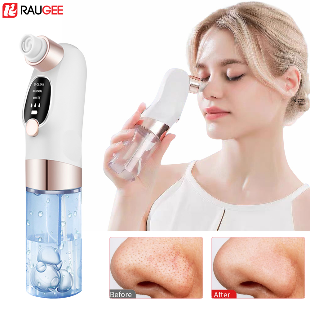 Blackhead Remover Electric Bla - огляд і ціна Pore Vacuum