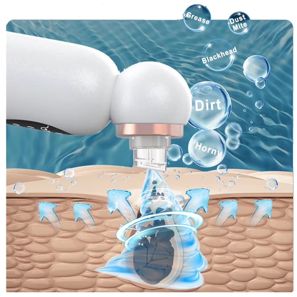 Blackhead Remover Pore Vacuum  - огляд і ціна Pore Vacuum