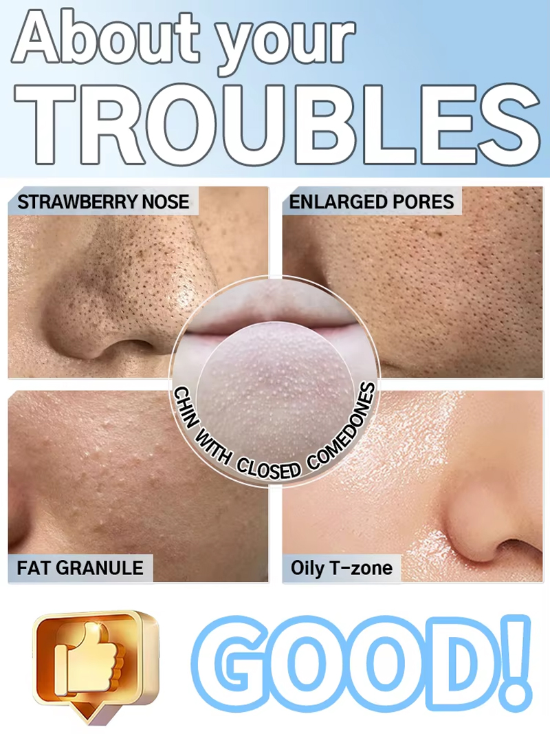 Blackhead Remover Pore Cleaner - огляд і ціна Pore Vacuum