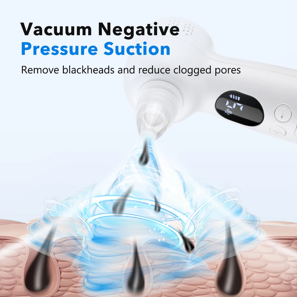 Blackhead Remover Pore Vacuum  - огляд і ціна Pore Vacuum