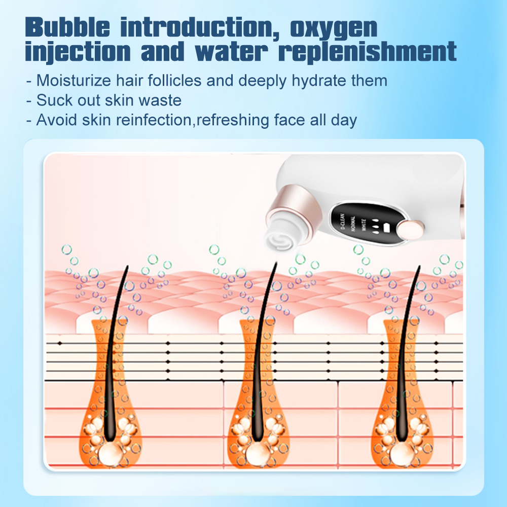 Electric Blackhead Remover Por - огляд і ціна Pore Vacuum