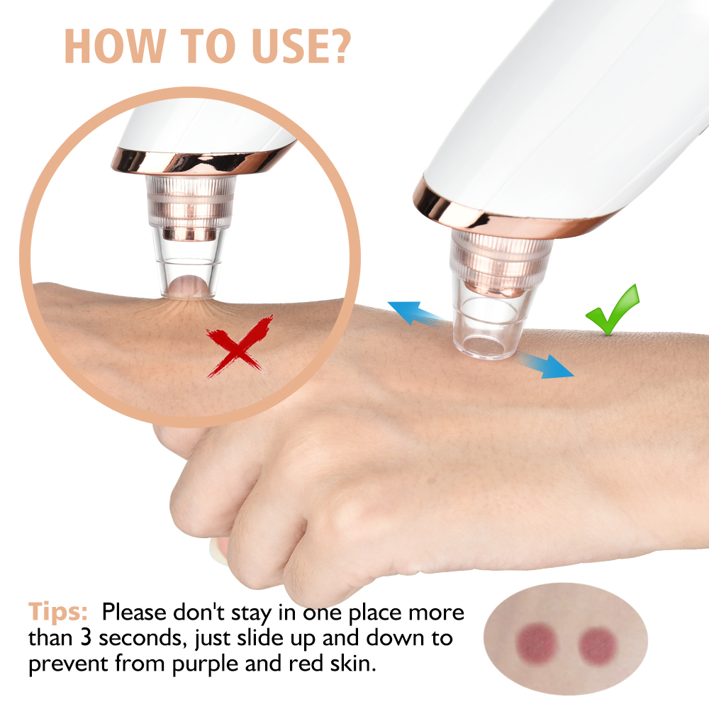 Blackhead Remover Vacuum Pore  - огляд і ціна Pore Vacuum