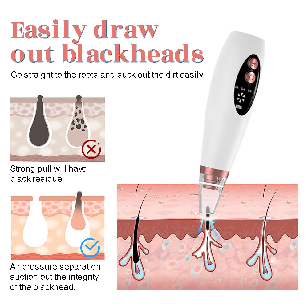 Electric Blackhead Remover Vac - огляд і ціна Pore Vacuum
