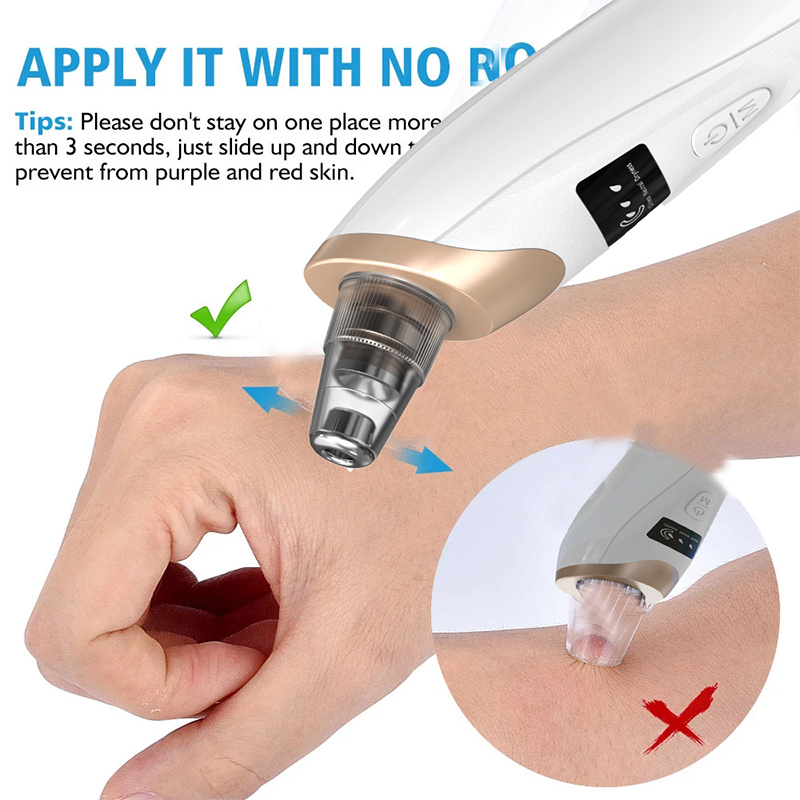 Blackhead Remover Pimples and  - огляд і ціна Pore Vacuum